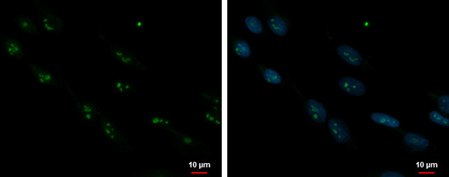 ORC3 Antibody in Immunocytochemistry (ICC/IF)