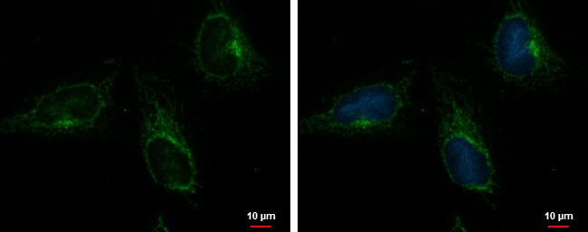 ACOT9 Antibody in Immunocytochemistry (ICC/IF)