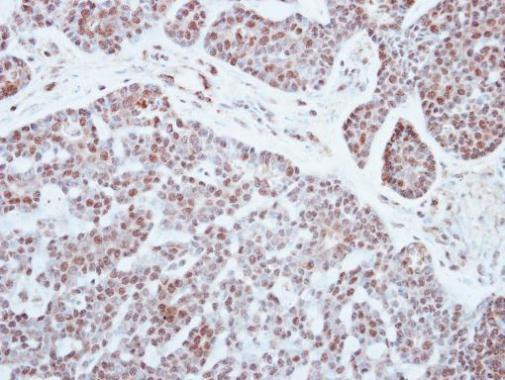 PATZ1 Antibody in Immunohistochemistry (Paraffin) (IHC (P))
