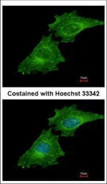 Coronin 3 Antibody in Immunocytochemistry (ICC/IF)