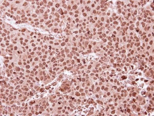 MKRN1 Antibody in Immunohistochemistry (Paraffin) (IHC (P))
