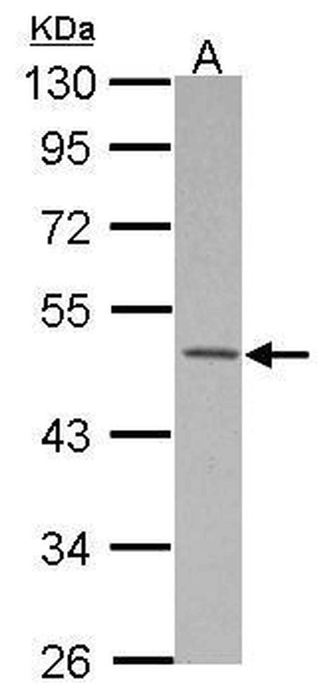 MKRN2 Antibody in Western Blot (WB)