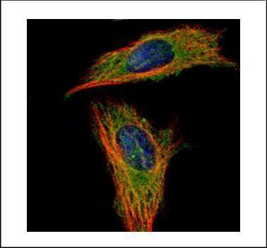 RABGAP1 Antibody in Immunocytochemistry (ICC/IF)