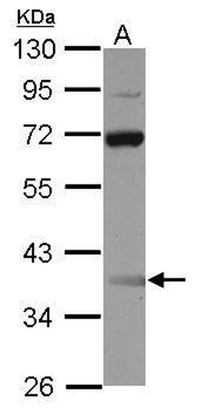 SSBP3 Antibody in Western Blot (WB)