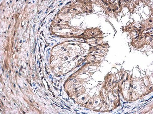 TRIM29 Antibody in Immunohistochemistry (Paraffin) (IHC (P))