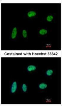 KIF4A Antibody in Immunocytochemistry (ICC/IF)