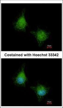 EML2 Antibody in Immunocytochemistry (ICC/IF)