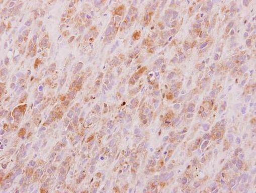 FUS2 Antibody in Immunohistochemistry (Paraffin) (IHC (P))