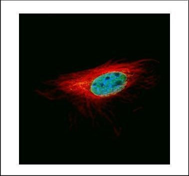 L3MBTL1 Antibody in Immunocytochemistry (ICC/IF)