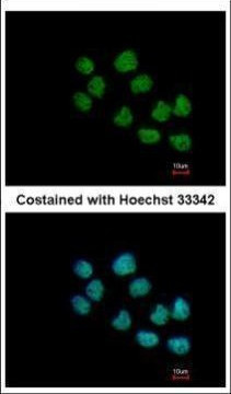 CREST Antibody in Immunocytochemistry (ICC/IF)