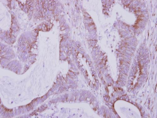 FBXO6 Antibody in Immunohistochemistry (Paraffin) (IHC (P))