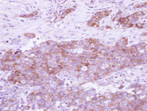 ARFGAP3 Antibody in Immunohistochemistry (Paraffin) (IHC (P))