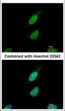 NARF Antibody in Immunocytochemistry (ICC/IF)