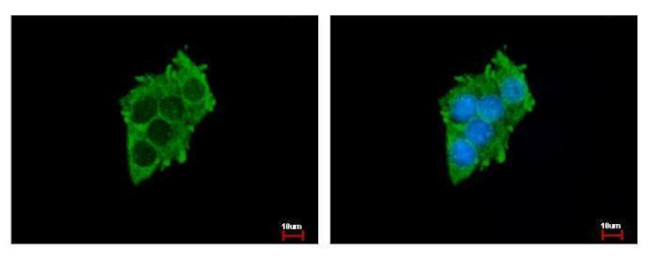 SLC17A5 Antibody in Immunocytochemistry (ICC/IF)