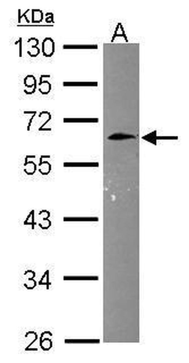 CNNM3 Antibody in Western Blot (WB)