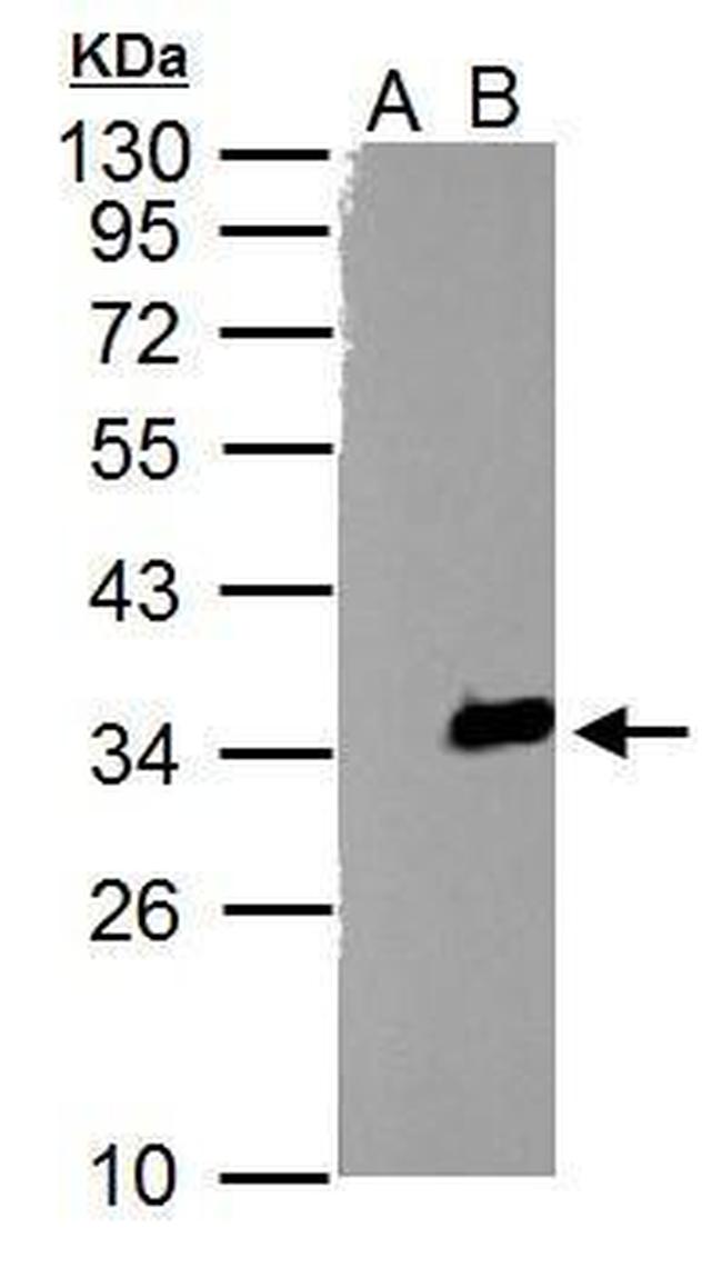 TZFP Antibody in Western Blot (WB)