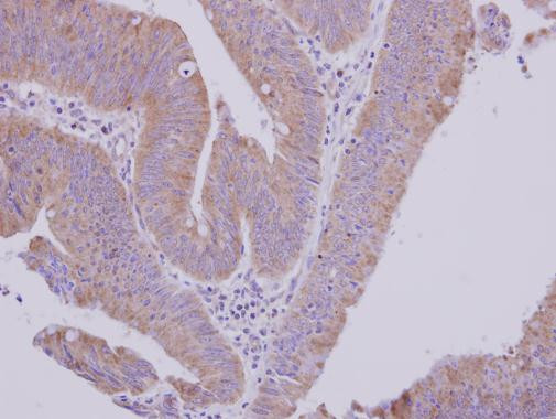 MTBP Antibody in Immunohistochemistry (Paraffin) (IHC (P))