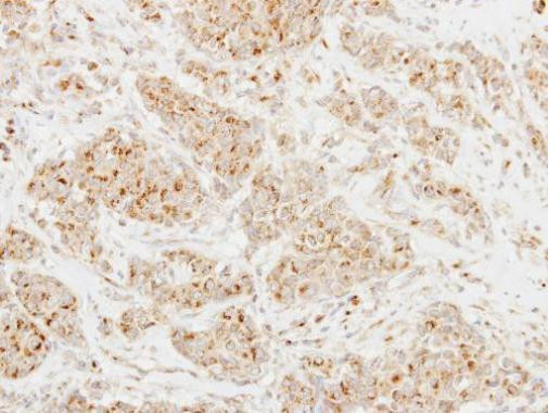 CLUL1 Antibody in Immunohistochemistry (Paraffin) (IHC (P))
