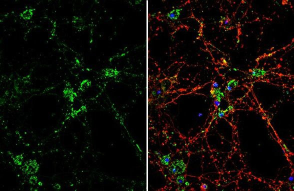 DKK3 Antibody in Immunocytochemistry (ICC/IF)