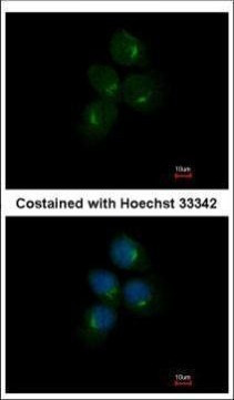 CHIA Antibody in Immunocytochemistry (ICC/IF)