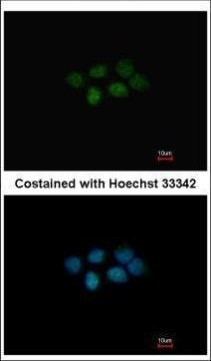 MAT2B Antibody in Immunocytochemistry (ICC/IF)