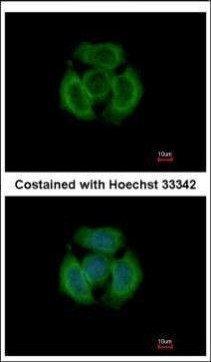 TMOD3 Antibody in Immunocytochemistry (ICC/IF)