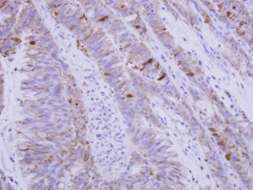 SNX15 Antibody in Immunohistochemistry (Paraffin) (IHC (P))