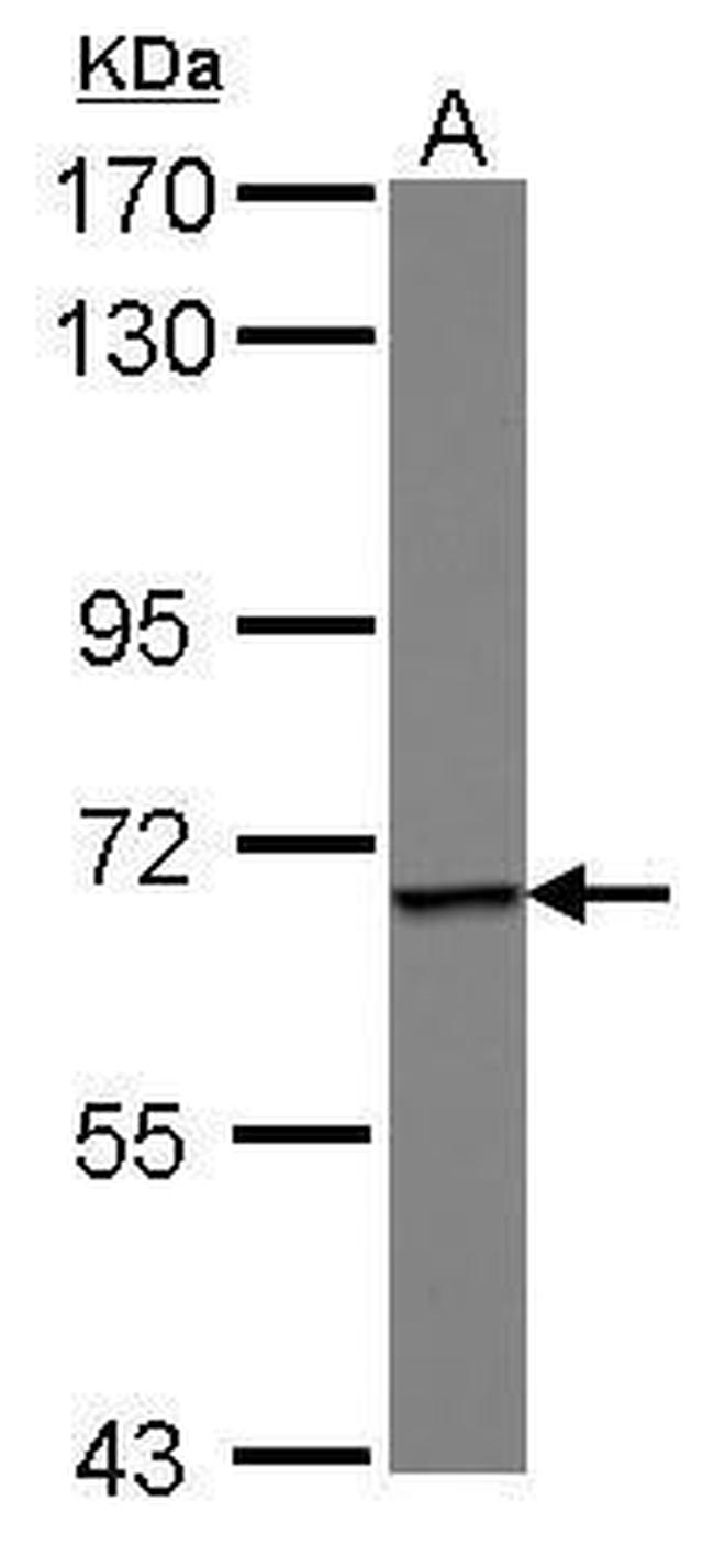 Epsin 1 Antibody in Western Blot (WB)