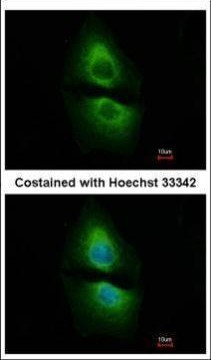 PSAT1 Antibody in Immunocytochemistry (ICC/IF)