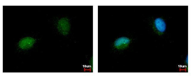 NARF Antibody in Immunocytochemistry (ICC/IF)