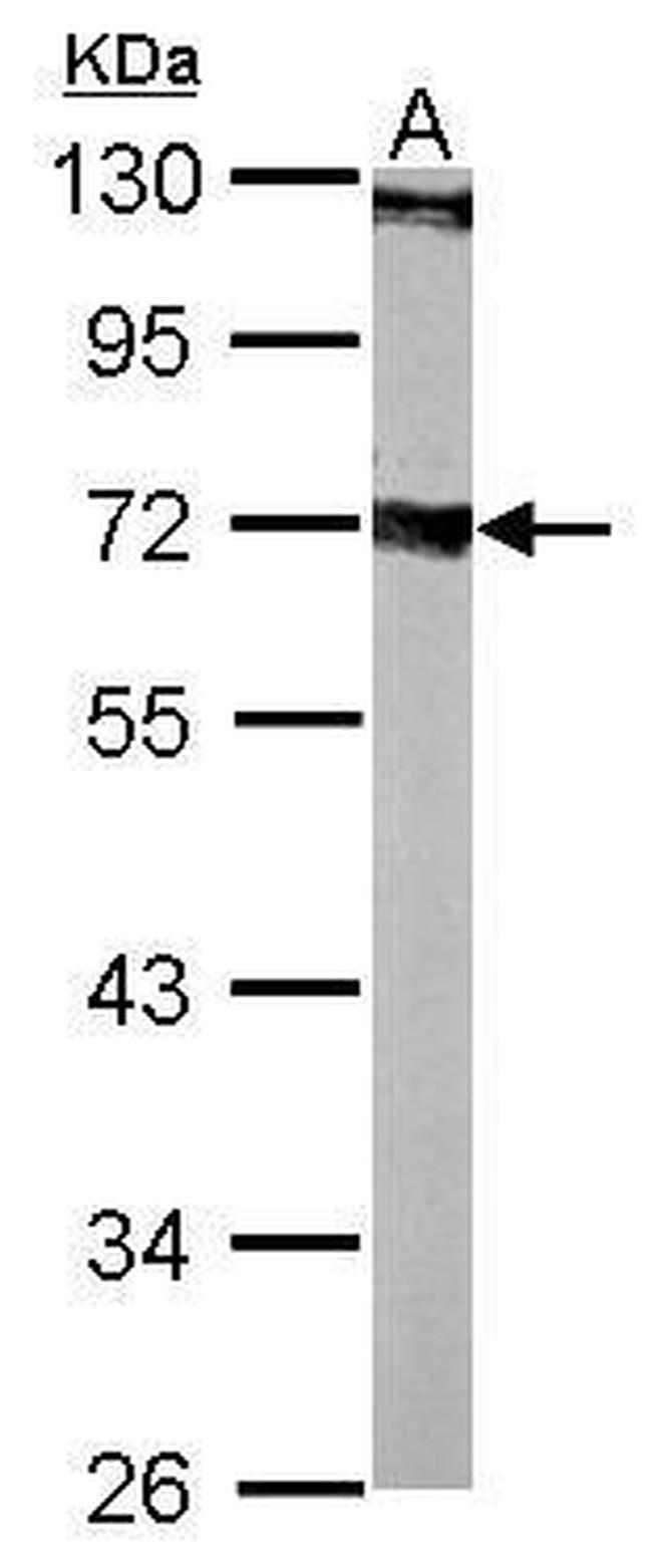 Septin-9 Antibody in Western Blot (WB)