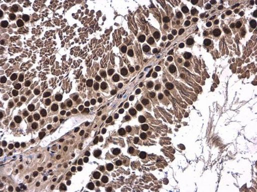 FUBP3 Antibody in Immunohistochemistry (Paraffin) (IHC (P))