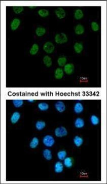 CARP Antibody in Immunocytochemistry (ICC/IF)