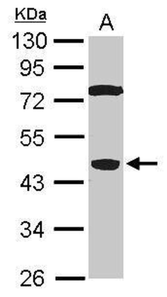 SPO11 Antibody in Western Blot (WB)