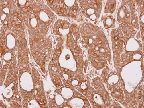 CEP57 Antibody in Immunohistochemistry (Paraffin) (IHC (P))