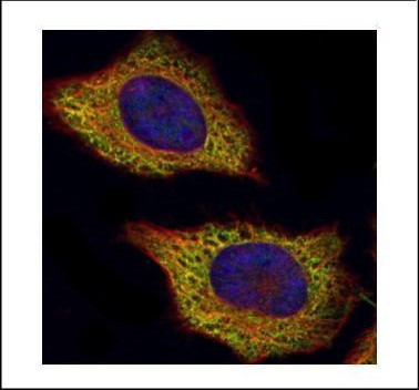 VPS28 Antibody in Immunocytochemistry (ICC/IF)