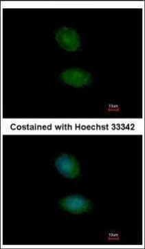 AMMECR1 Antibody in Immunocytochemistry (ICC/IF)