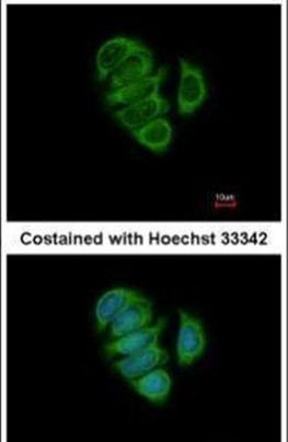 CaMKK beta Antibody in Immunocytochemistry (ICC/IF)