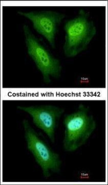 FBXL4 Antibody in Immunocytochemistry (ICC/IF)