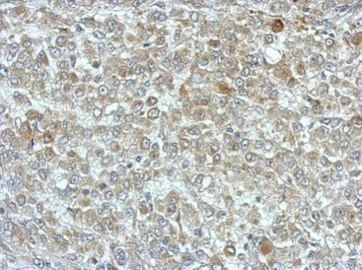 PPME1 Antibody in Immunohistochemistry (Paraffin) (IHC (P))