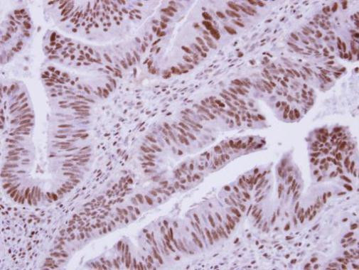 DCPS Antibody in Immunohistochemistry (Paraffin) (IHC (P))