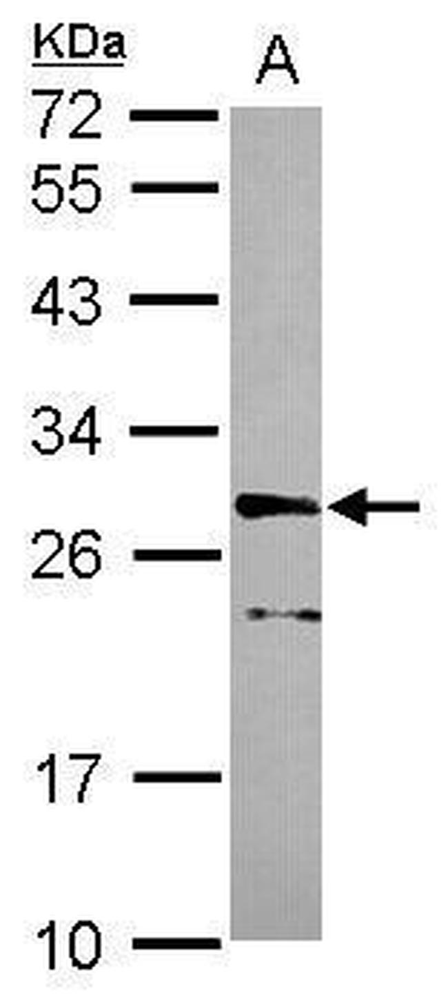 CDK10 Antibody in Western Blot (WB)