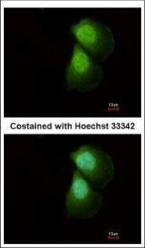 PRMT5 Antibody in Immunocytochemistry (ICC/IF)