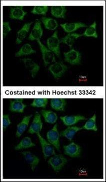 LOR Antibody in Immunocytochemistry (ICC/IF)