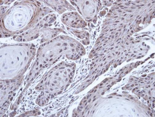 FANCD2 Antibody in Immunohistochemistry (Paraffin) (IHC (P))