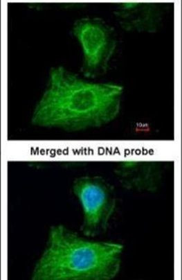 GPX1 Antibody in Immunocytochemistry (ICC/IF)