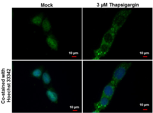 LC3B Antibody in Immunocytochemistry (ICC/IF)