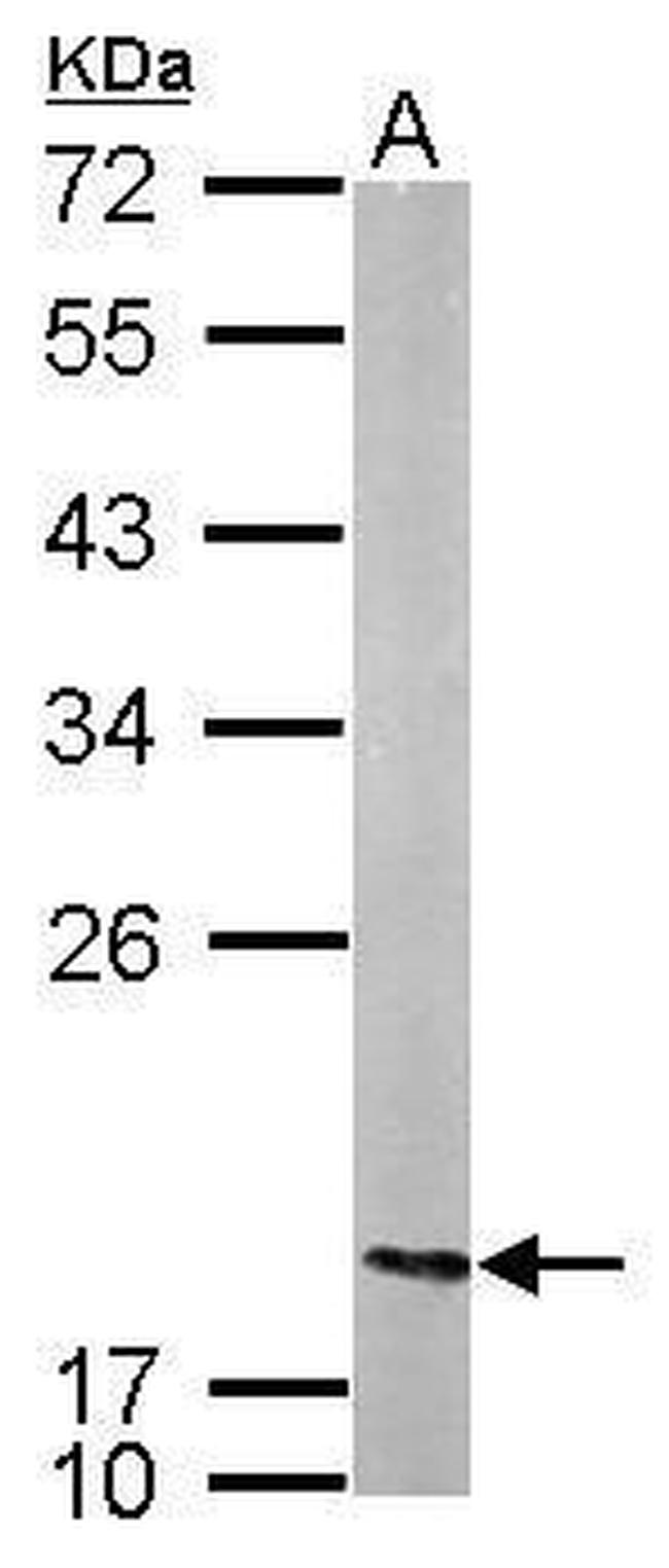 NME2 Antibody in Western Blot (WB)