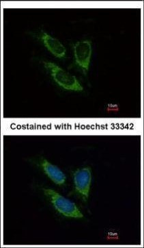 SOD2 Antibody in Immunocytochemistry (ICC/IF)