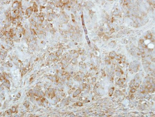 KCNIP1 Antibody in Immunohistochemistry (Paraffin) (IHC (P))